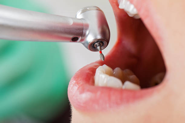 Best Emergency Dental Care for Trauma or Injury in Gresham Park, GA